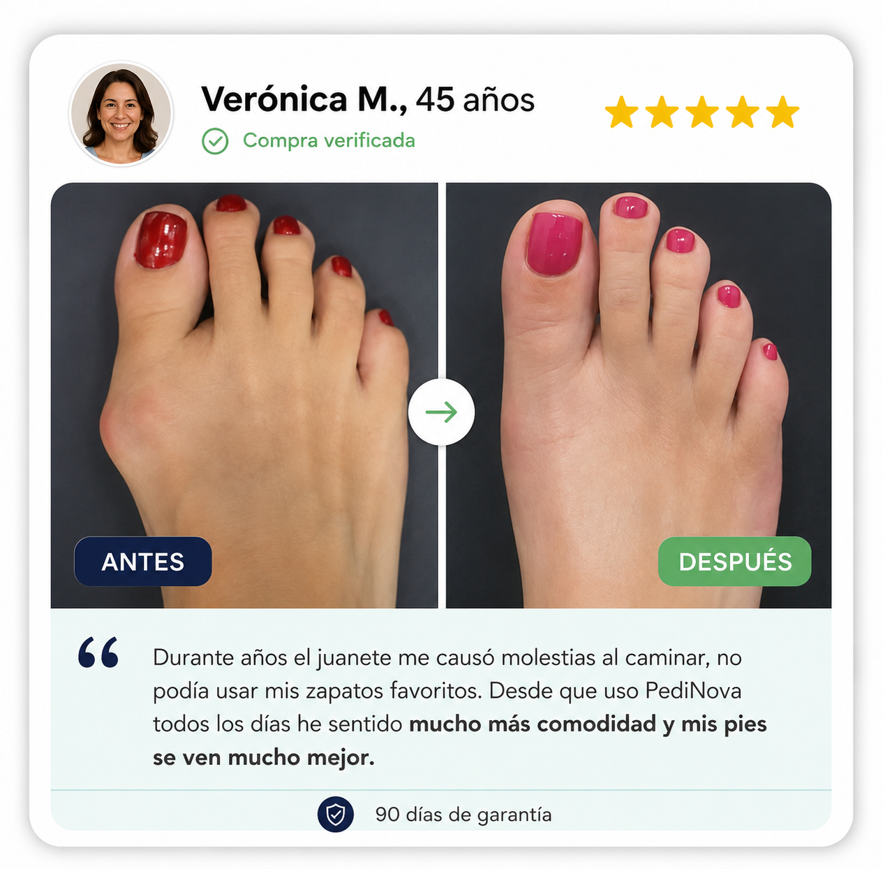 PediNova Align™ | Corrector Ajustable para Juanetes